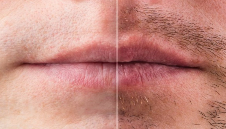 Köselik kader değil