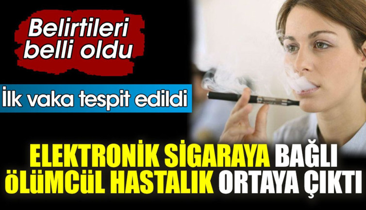 Elektronik sigaraya bağlı ölümcül hastalık ortaya çıktı. Belirtileri belli oldu. İlk vaka tespit edildi