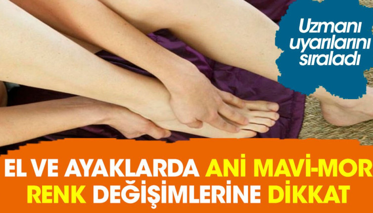 El ve ayaklarda ani mavi-mor renk değişimlerine dikkat. Uzmanı uyarılarını sıraladı