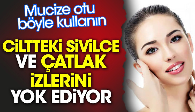 Mucize otu böyle kullanırsanız ciltteki sivilce ve çatlak izlerini yok ediyor