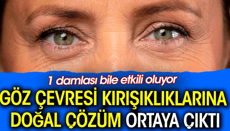 Göz çevresi kırışıklıklarına doğal çözüm ortaya çıktı. 1 damlası bile etkili oluyor