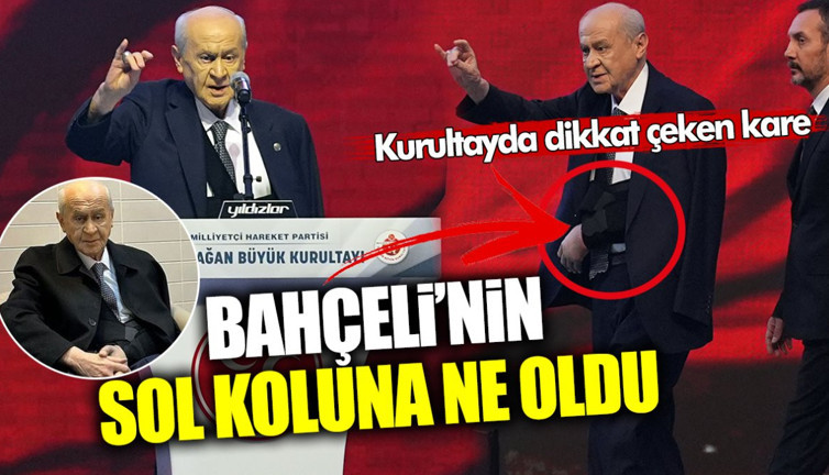 Devlet Bahçeli’nin sol koluna ne oldu? MHP’den kurultay günü resmi açıklama geldi