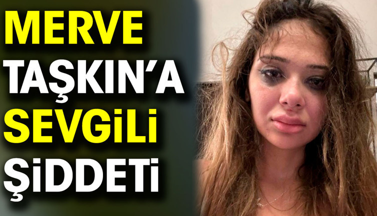 Sosyal medya fenomeni Merve Taşkın sevgilisinden gördüğü şiddeti paylaştı