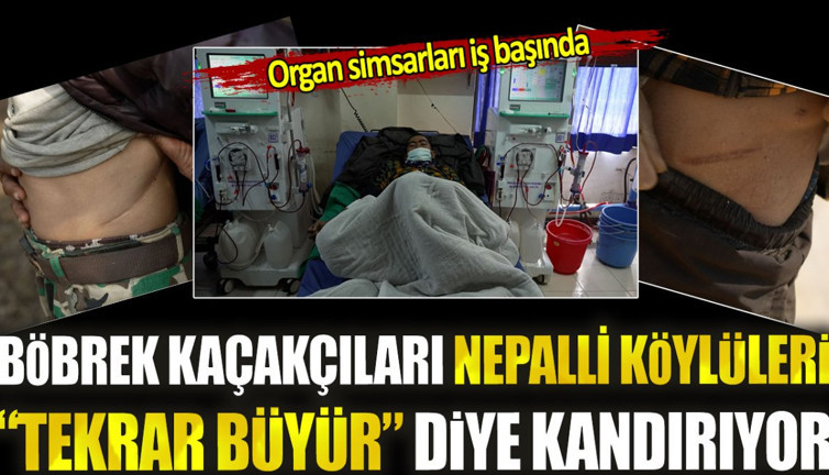 Böbrek kaçakçıları Nepalli köylüleri tekrar büyür diye kandırıyor. Organ simsarları iş başında