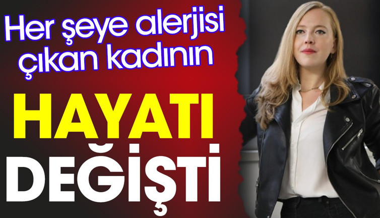 Her şeye alerjisi çıkan kadının hayatı değişti