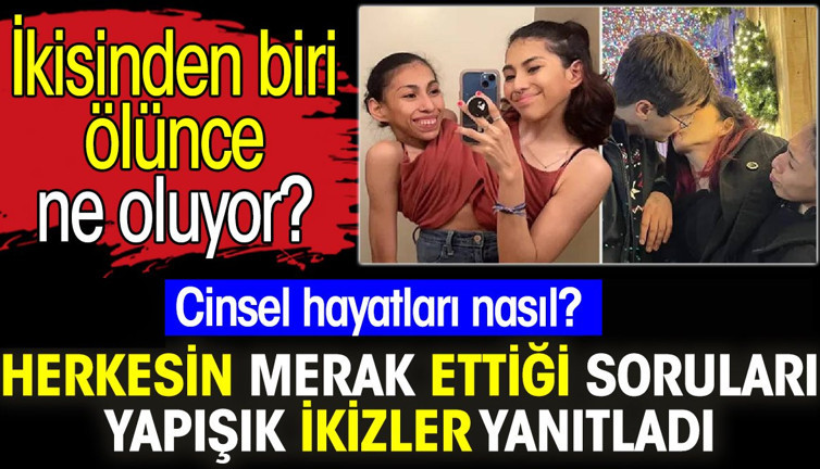 Yapışık ikizler herkesin merak ettiği soruları yanıtladı. Cinsel hayatları nasıl? İkisinden biri ölünce ne oluyor?