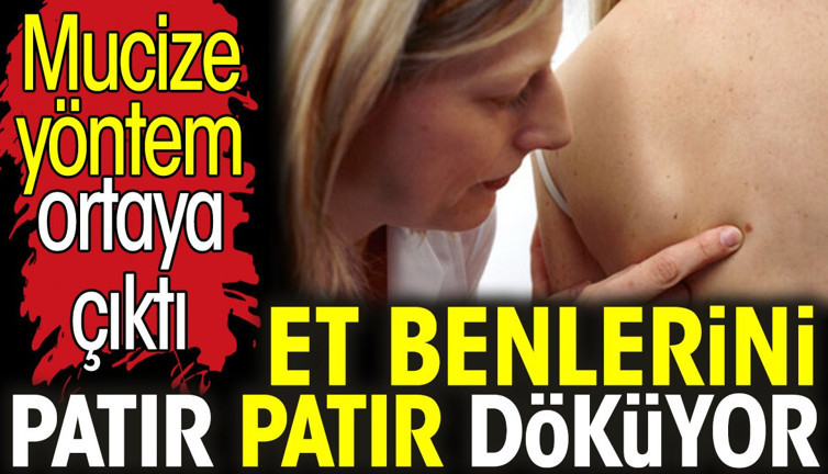 Et benlerini patır patır döküyor. Mucize yöntem ortaya çıktı