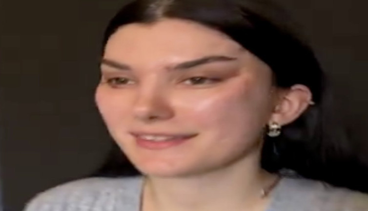 Güzelleşmek için yüz gerdiren genç kadının korkutan değişimi