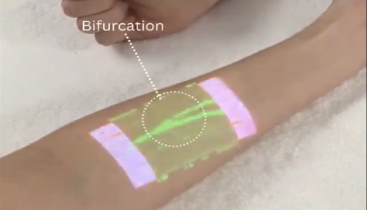 Cilt üzerinden damar görüntüleme teknolojisi: Tıpta yenilikçilik