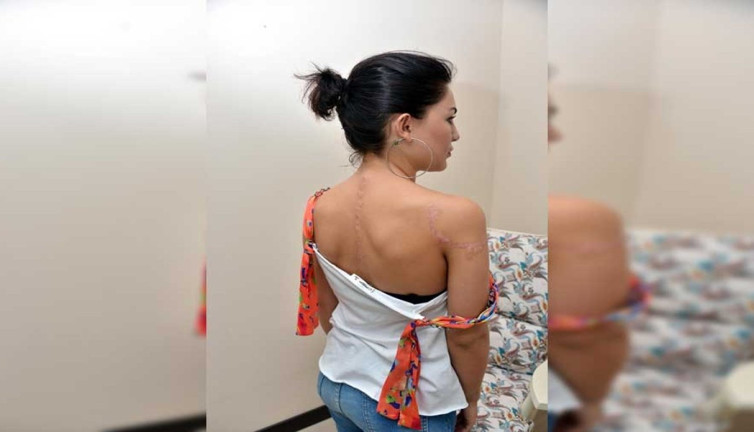 Dövmeyi sakın yanlış silmeyin! Büyük tehlikeler ortaya çıktı. Uzmanlardan hayat kurtaran uyarılar