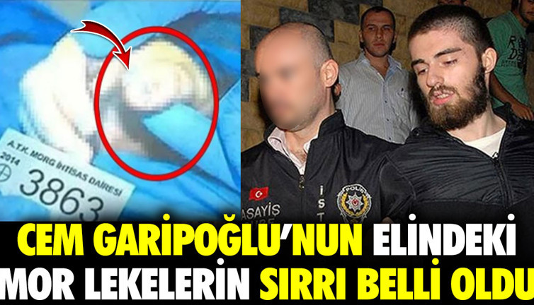 Cem Garipoğlu’nun elindeki mor lekelerin sırrı belli oldu