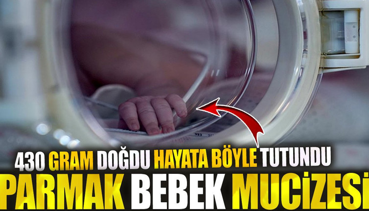 Parmak Bebek mucizesi! 430 gram doğdu hayata böyle tutundu