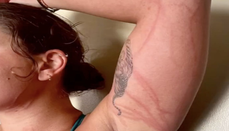 Açık deniz yüzücüsü Bengisu Avcı deniz anası saldırısına uğradı