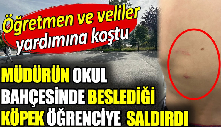 Müdürün okul bahçesinde beslediği köpek öğrenciye saldırdı. Öğretmen ve veliler yardımına koştu