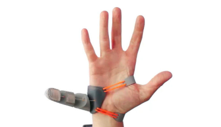 6. parmağınız olsun ister miydiniz?