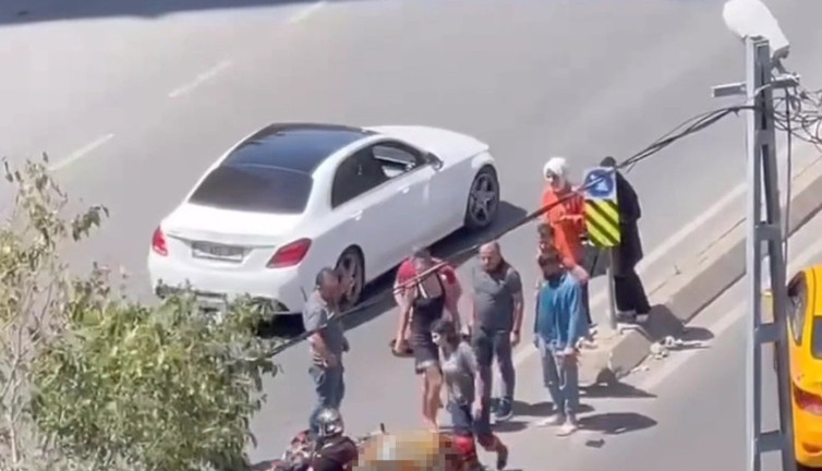 Kaza yaptı kendini unuttu motosikletine üzüldü