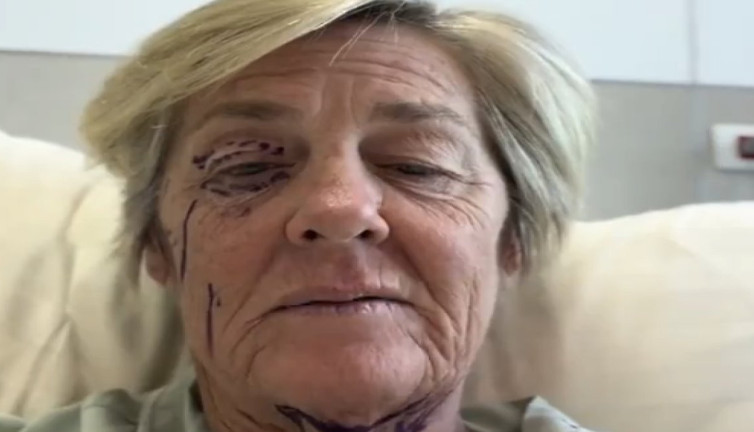 Estetik operasyonlar sonrası neredeyse 20 yaş gençleşti