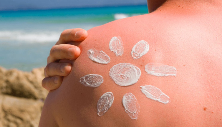 Güneş yanıkları nasıl iyileşir? Uzman görüşleri ve bilimsel araştırmalardan ortaya çıktı