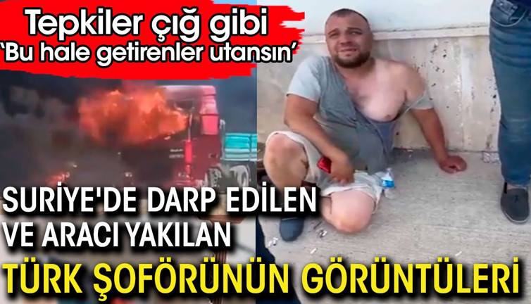 Canını Suriyelilerden zor kurtaran Türk şoförünün hali yürek yaktı. Bu hale getirenler utansın