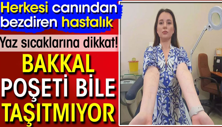 Herkesi canından bezdiren hastalık! Bakkal poşeti bile taşıtmıyor