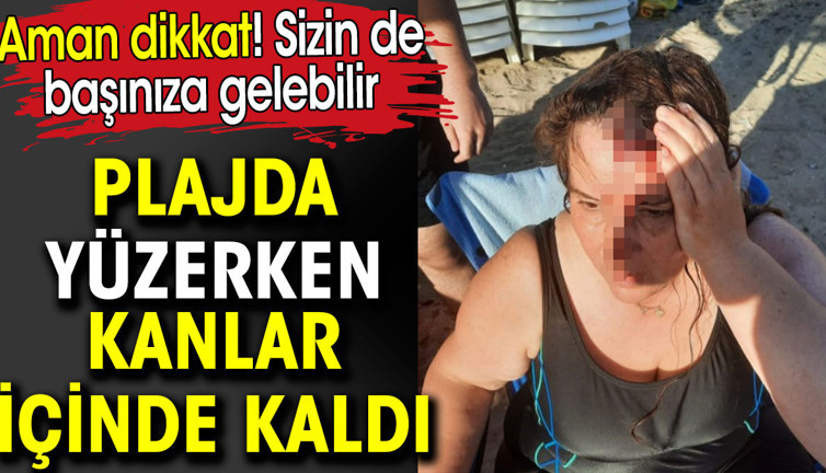 Plajda yüzerken kanlar içinde kaldı. Sizin de başınıza gelebilir