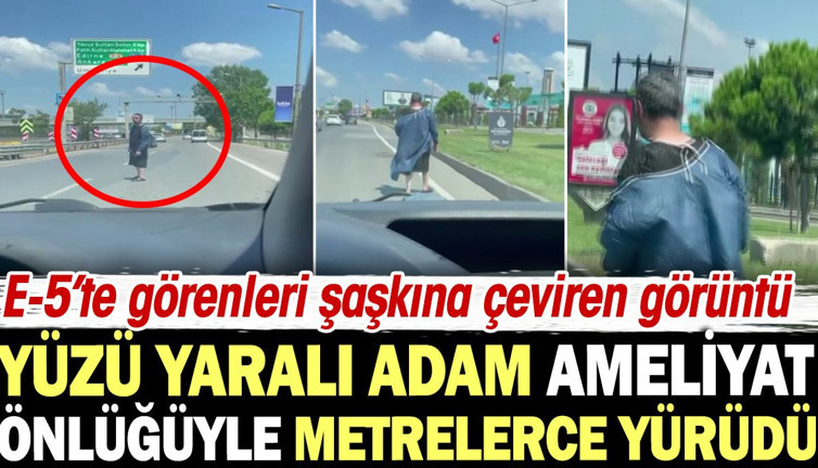 E-5'te görenleri şaşkına çeviren görüntü! Yüzü yaralı adam ameliyathane önlüğüyle metrelerce yürüdü
