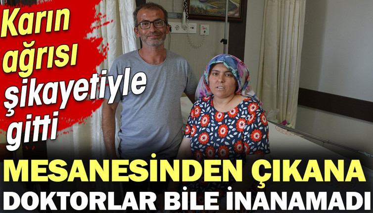Mesanesinden çıkana doktorlar bile inanamadı. Karın ağrısı şikayetiyle gitti