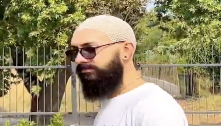 Saçları olmayan erkek arkadaşını kafasını boncuklarla süsledi