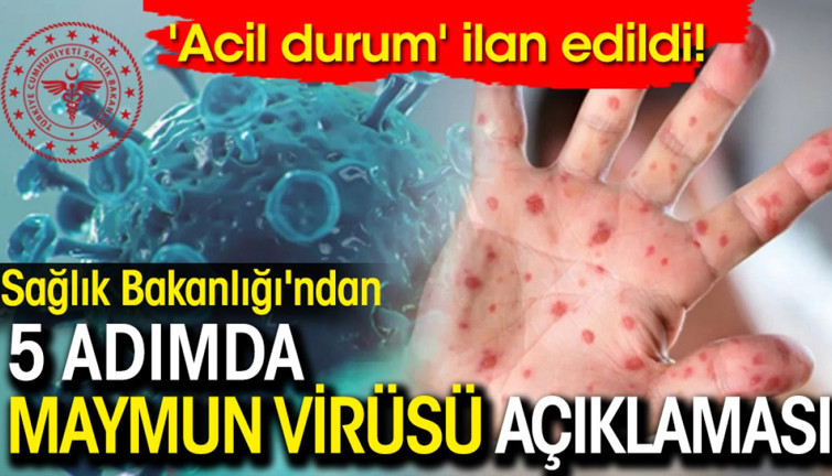 Sağlık Bakanlığı'ndan 5 adımda maymun virüsü açıklaması: 'Acil durum' olarak ilan edildi!
