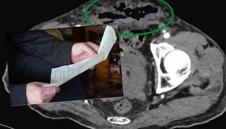 Alkolik adam hastaneye kaldırıldı! Kontrolden çıkan sonucu görünce başından aşağı kaynar sular döküldü