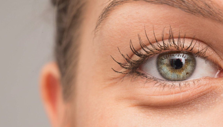 Göz altı morluklarınızı doğal yöntemle çözün