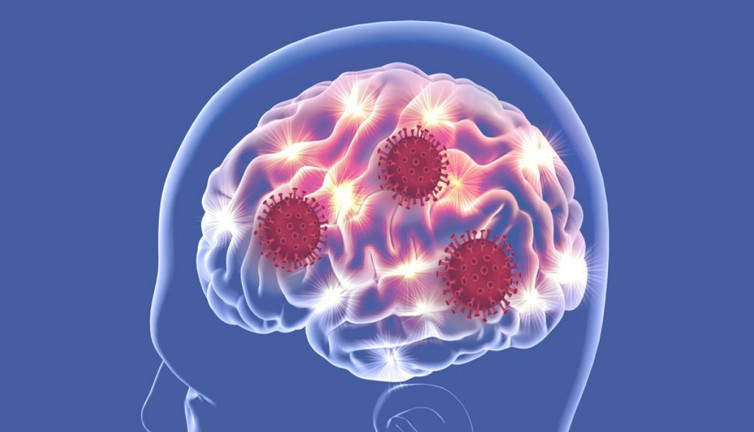 COVID-19'u hafif geçirenlerde kalıcı beyin hasarı tespit edildi