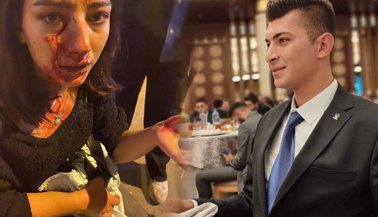 AKP'li Gençlik Kolları Başkanı kadını hastanelik etti. Burnunu kırdı! "Nasıl vurdum' diye övündü"