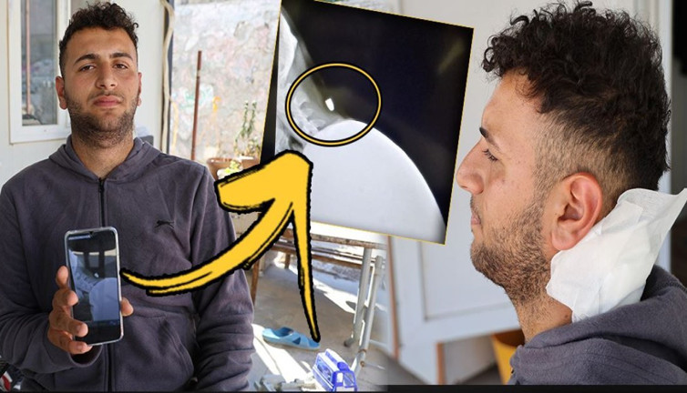 2 santimle hayatta kaldı! Molada sohbet ederken başına gelenle şoke oldu