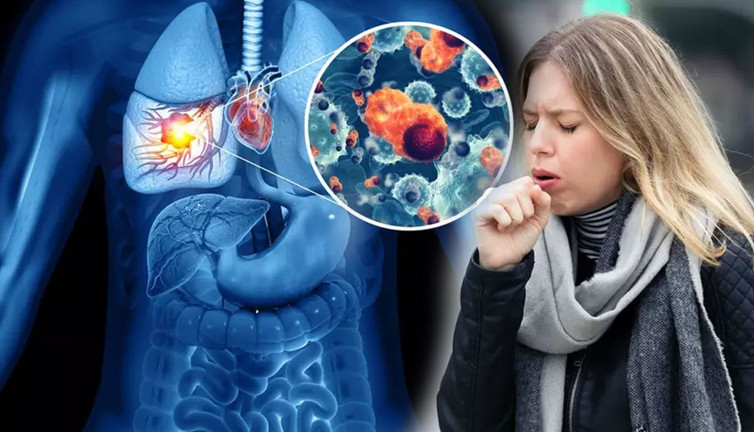 Bitmeyen öksürüğe dikkat! Sakın soğuk algınlığı ile karıştırmayın