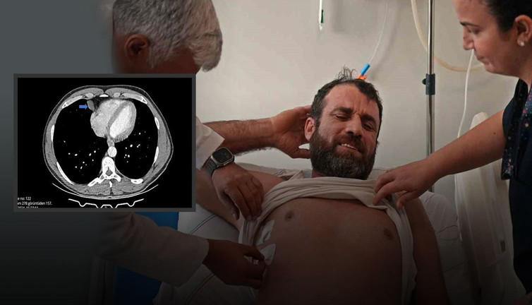 Hapşırıp, öksürünce grip olduğunu sandı, hastaneye gidince gerçeğin bambaşka olduğunu öğrendi