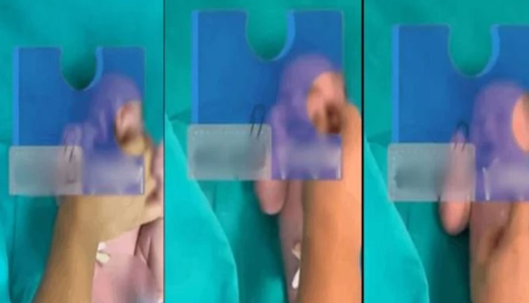 Yenidoğan Çetesi'nin kız bebeğe yaptıkları eziyet ortaya çıktı! Yürek kanatan görüntü