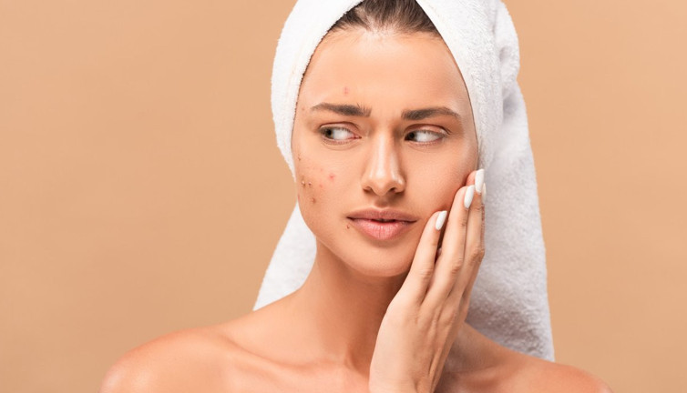 Sivilce psikolojisine uzmanların bakışı...