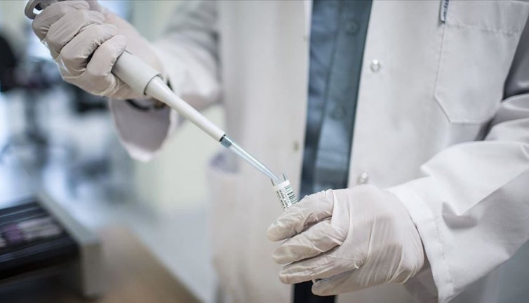 AIDS şüphesine ’test’ önerisi