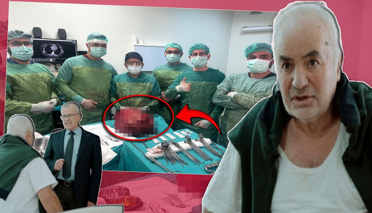 Karnında şişlik ve bulantı şikayetiyle gitti: Profesör 13 kiloluk dev kitleyi görünce şaşkına döndü