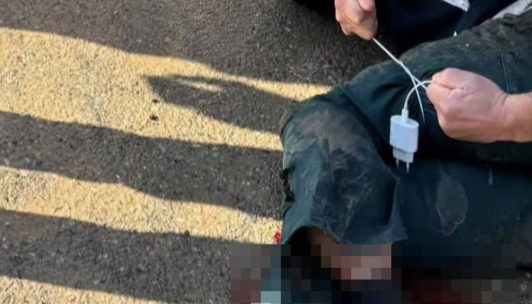 Kazada yaralıya şarj kablosuyla turnike yapıldı