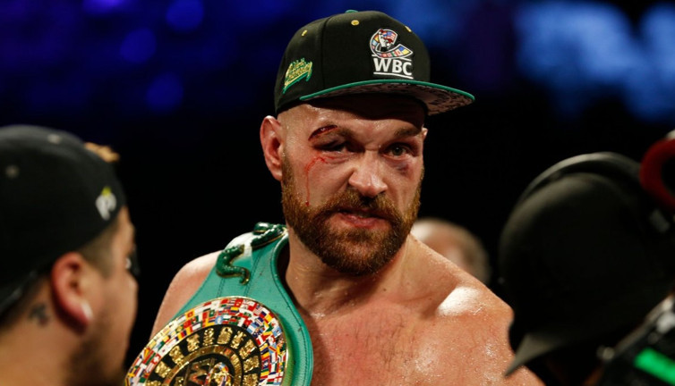 Tyson Fury ringlere veda etti