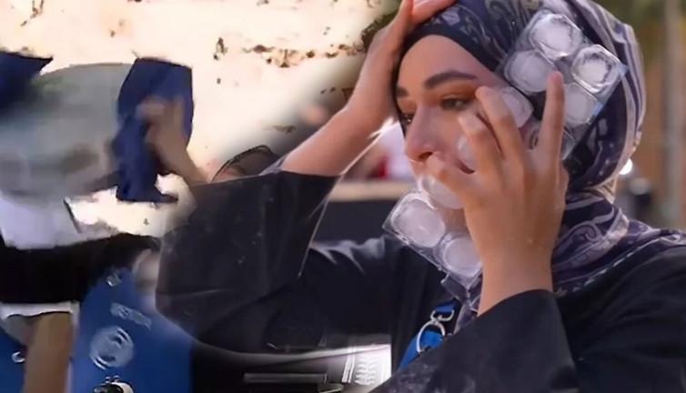 Yüzüne kızgın yağ dökülmüş, kurgu denmişti! MasterChef Beyza yüzünü ilk kez paylaştı