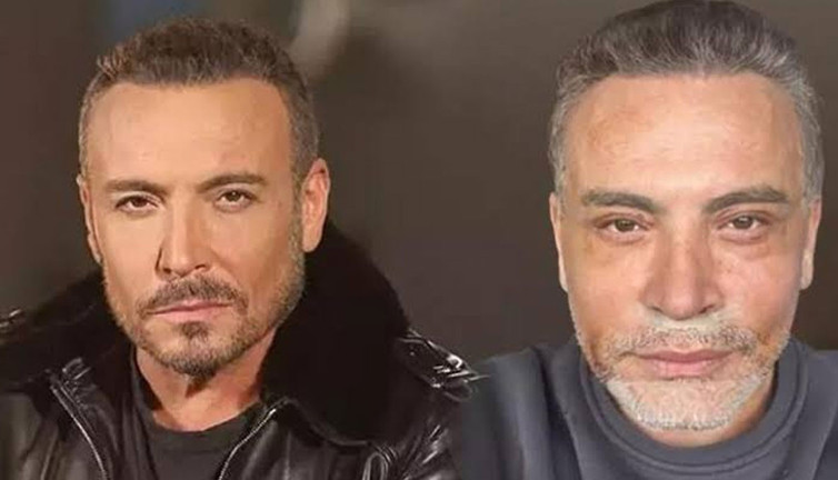 Cenk Eren neden estetik olduğunu açıkladı!