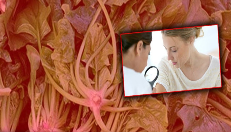 Cilt kanserine karşı doğal kalkan olan 7 süper besin