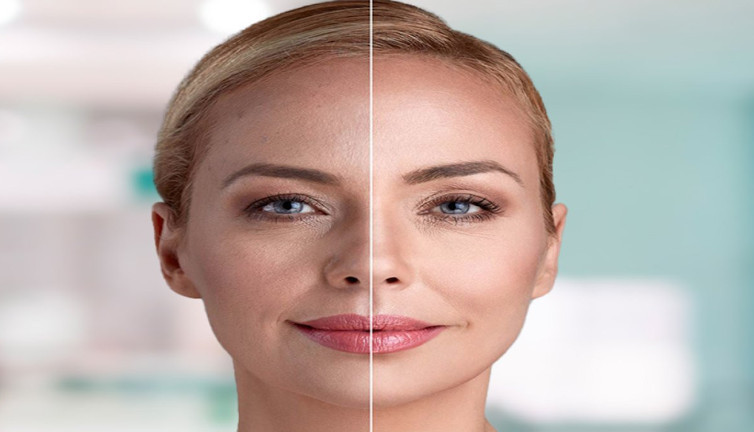 İnce kırışıklıklara veda! Cilt gençleştirmede çığır açan yöntem