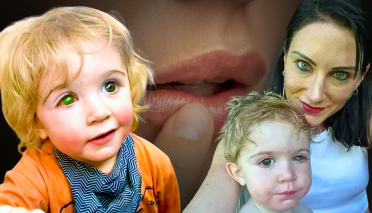 Anne babalar dikkat! 2 yaşındaki çocuk öpüldüğü için kör oldu