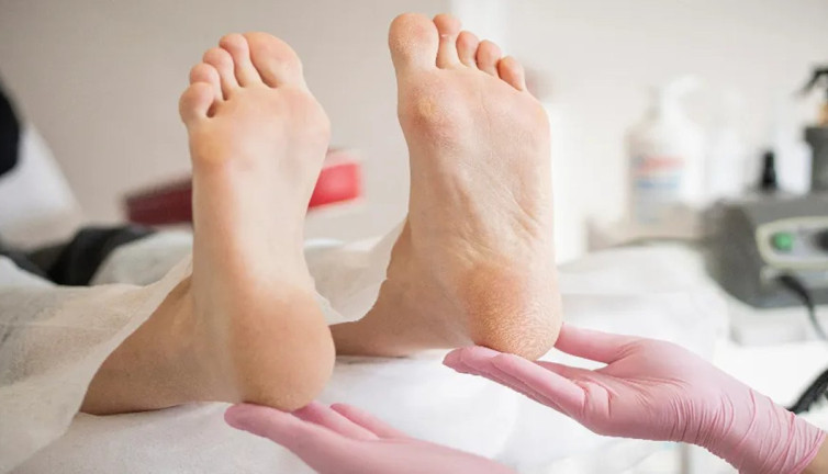 Koparılan nasırın gizli tehlikesi: Ayağınızdan olabilirsiniz! Uzmanlar uyarılarını açıkladı