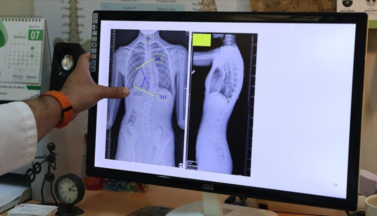 Ergenlikte yaşanan büyük tehlike alarm veriyor! Uzmanlar konuştu