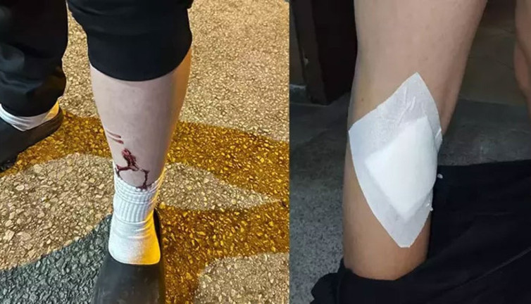 Başıboş köpekler 2 çocuğu ısırdı